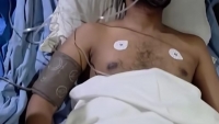 গুরুতর আহত নূরকে  হাসপাতালে দেখতে যান বিপ্লবী ওয়ার্কার্স পার্টির সাধারণ সম্পাদক সাইফুল হক