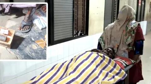 কুষ্টিয়ার লাহিনী বটতলায় রহস্যজনক বিস্ফোরনে আহত-১